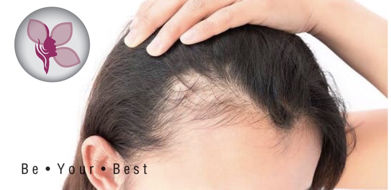 Fue Hair Transplant Female in Ahmedabad