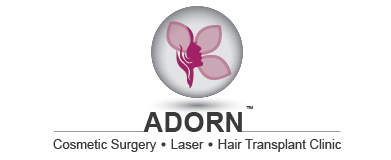 Hair Transplant in Women